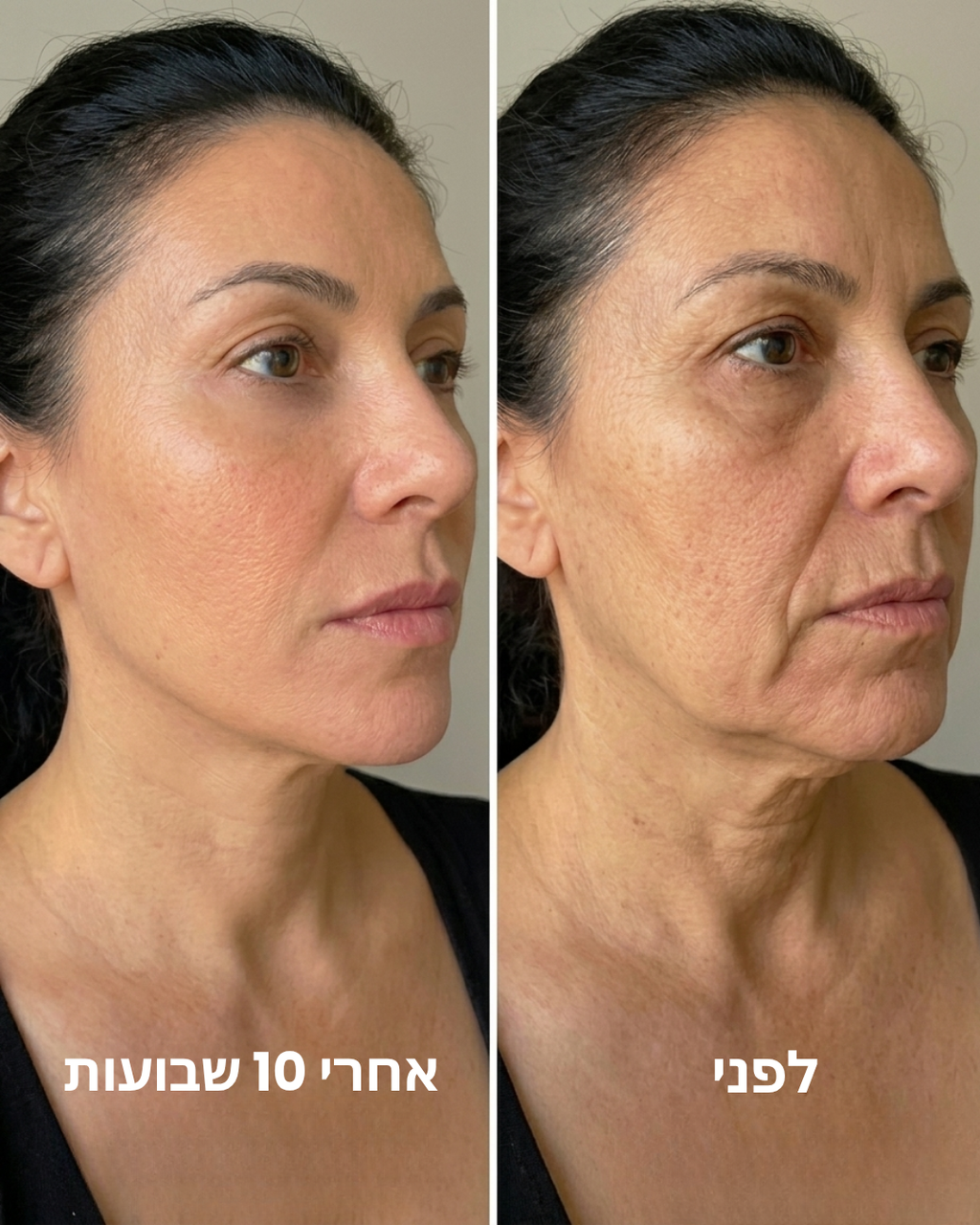 מסיכת קולגן לעיצוב קו הלסת