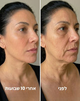 מסיכת קולגן לעיצוב קו הלסת