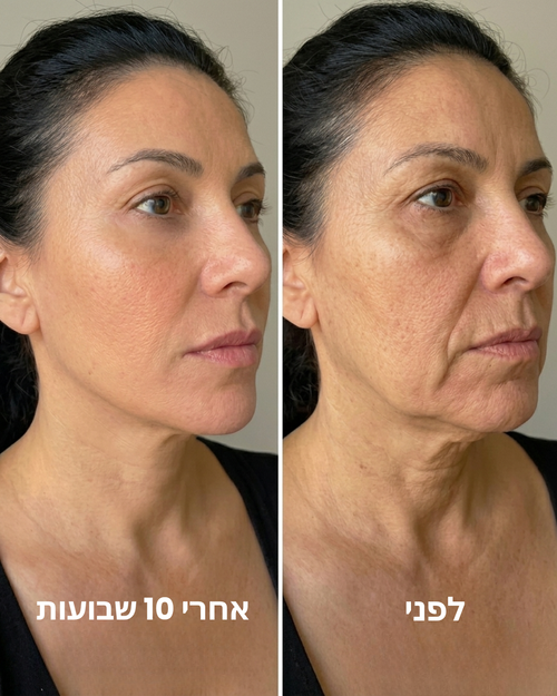 מסיכת קולגן לעיצוב קו הלסת